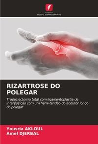 Produktbild: Rizartrose Do Polegar