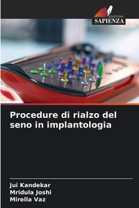 Produktbild: Procedure di rialzo del seno in implantologia