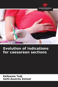 Produktbild: Evolution of indications for caesarean sections