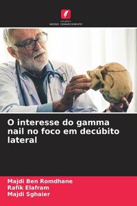 Produktbild: O interesse do gamma nail no foco em dec&uacute;bito lateral