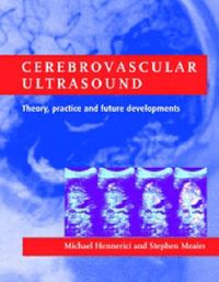 Produktbild: Cerebrovascular Ultrasound