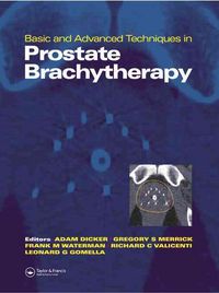 Produktbild: Basic and Advanced Techniques in Prostate Brachytherapy