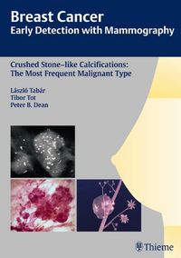 Produktbild: Breast Cancer: Early Detection with Mammography