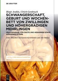Produktbild: Schwangerschaft, Geburt und Wochenbett von Zwillingen und h&ouml;hergradigen Mehrlingen