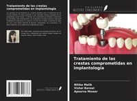 Produktbild: Tratamiento de las crestas comprometidas en implantolog&iacute;a