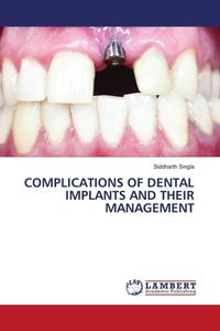 Produktbild: Complications Of Dental Implants and Their Management