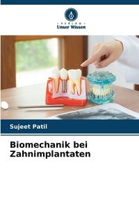 Produktbild: Biomechanik bei Zahnimplantaten