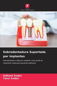 Produktbild: Sobredentadura Suportada por Implantes