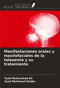 Produktbild: Manifestaciones orales y maxilofaciales de la talasemia y su tratamiento
