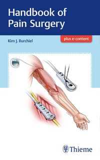 Produktbild: Handbook of Pain Surgery
