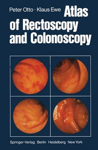 Produktbild: Atlas of Rectoscopy and Coloscopy