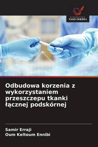 Produktbild: Odbudowa korzenia z wykorzystaniem przeszczepu tkanki &iquest;&iquest;cznej podsk&oacute;rnej