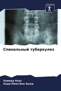 Produktbild: Spinal'nyj tuberkulez