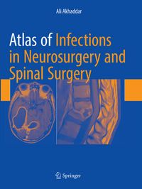 Produktbild: Atlas of Infections in Neurosurgery and Spinal Surgery