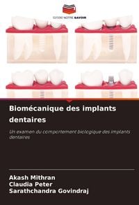 Produktbild: Biom&eacute;canique des implants dentaires
