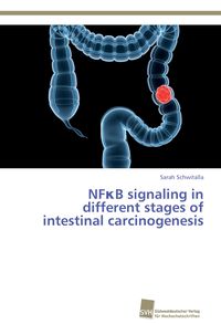 Produktbild: NF&iquest;B signaling in different stages of intestinal carcinogenesis