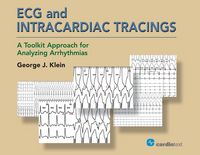 Produktbild: ECG and Intracardiac Tracings
