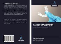 Produktbild: Parodontale Spalken