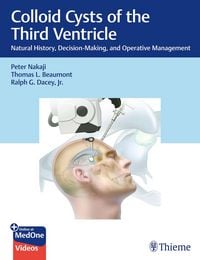 Produktbild: Colloid Cysts of the Third Ventricle