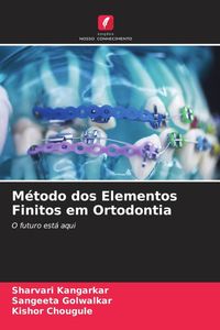 Produktbild: M&eacute;todo dos Elementos Finitos em Ortodontia