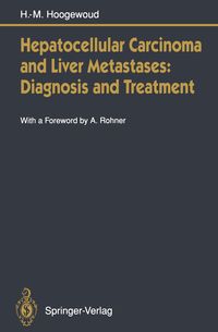 Produktbild: Hepatocellular Carcinoma and Liver Metastases: Diagnosis and Treatment