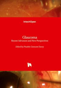 Produktbild: Glaucoma