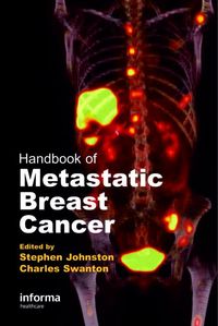 Produktbild: Handbook of Metastatic Breast Cancer