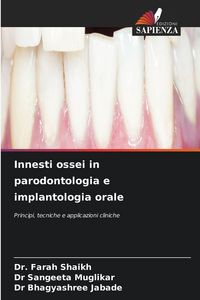 Produktbild: Innesti ossei in parodontologia e implantologia orale