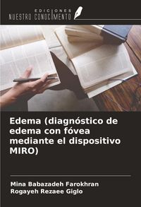 Produktbild: Edema (diagn&oacute;stico de edema con f&oacute;vea mediante el dispositivo MIRO)