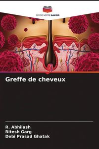 Produktbild: Greffe de cheveux