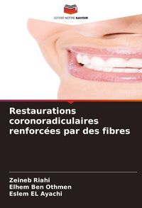 Produktbild: Restaurations coronoradiculaires renforc&eacute;es par des fibres