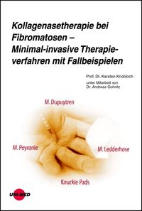 Produktbild: Kollagenasetherapie bei Fibromatosen - Minimal-invasive Therapieverfahren mit Fallbeispielen