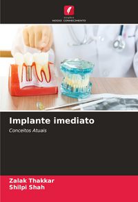 Produktbild: Implante imediato
