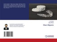 Produktbild: Clear Aligners