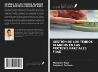 Produktbild: Gesti&oacute;n De Los Tejidos Blandos En Las Pr&oacute;tesis Parciales Fijas