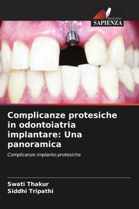 Produktbild: Complicanze protesiche in odontoiatria implantare: Una panoramica