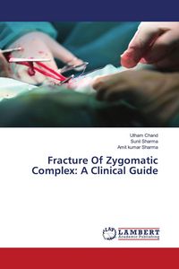 Produktbild: Fracture Of Zygomatic Complex: A Clinical Guide