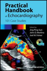 Produktbild: Practical Handbook of Echocardiography