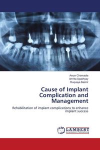 Produktbild: Cause of Implant Complication and Management