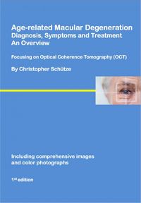 Produktbild: Age-related macular degeneration