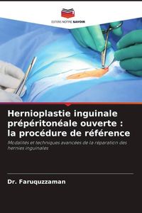 Produktbild: Hernioplastie inguinale pr&eacute;p&eacute;riton&eacute;ale ouverte : la proc&eacute;dure de r&eacute;f&eacute;rence