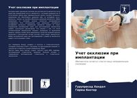 Produktbild: Uchet okkl&uuml;zii pri implantacii