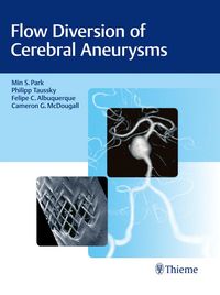 Produktbild: Flow Diversion of Cerebral Aneurysms