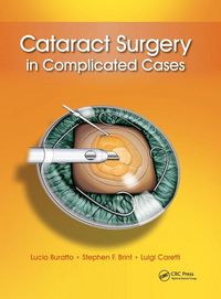 Produktbild: Cataract Surgery in Complicated Cases