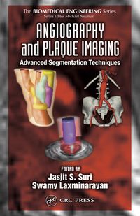 Produktbild: Angiography and Plaque Imaging