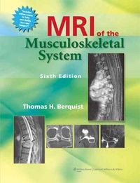 Produktbild: MRI of the Musculoskeletal System