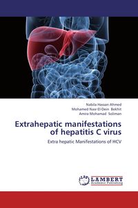 Produktbild: Extrahepatic manifestations of hepatitis C virus