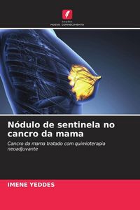 Produktbild: N&oacute;dulo de sentinela no cancro da mama