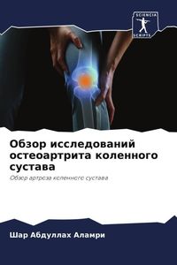 Produktbild: Obzor issledowanij osteoartrita kolennogo sustawa