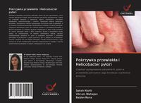 Produktbild: Pokrzywka przewlek&iquest;a i Helicobacter pylori
